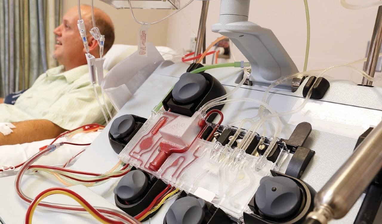 Coronavirus blood filtration system gets FDA nod for emergency use