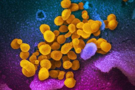 Nova Scotia’s COVID-19 cases rise to 293 in biggest single-day jump