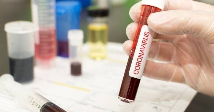 Ontario confirms 100 new coronavirus cases and 5 more deaths, total jumps to 671 active cases