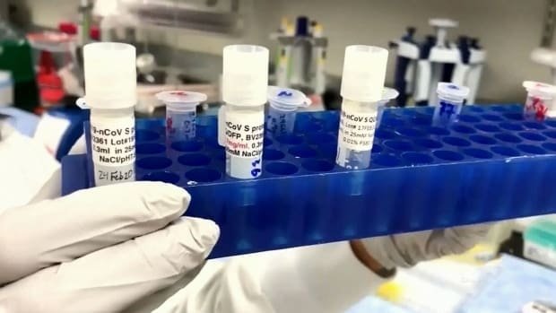 241 new COVID-19 cases in Alberta confirmed on Sunday in biggest single day jump