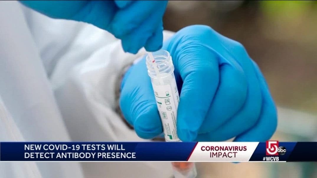 New COVID-19 tests will detect antibody presence
