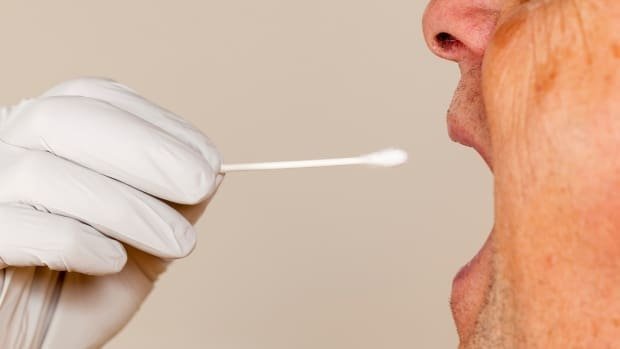 A saliva test could detect COVID-19: Yale researchers