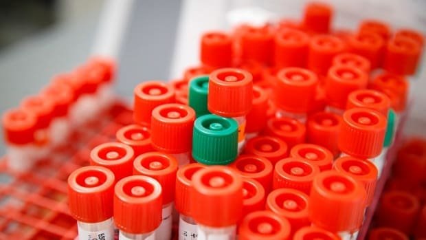 New COVID-cases, but no deaths in Middlesex-London, Oxford-Elgin or Lambton