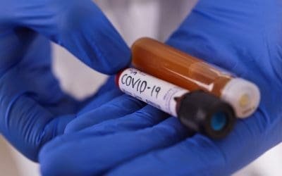 New COVID-19 case, one more recovered