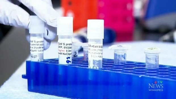 Manitoba researchers launch global clinical trial that could improve survival of COVID-19
