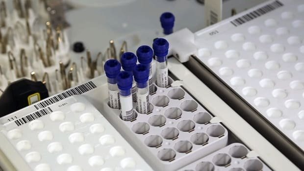 Canada’s first antibody test marks step forward in COVID-19 response